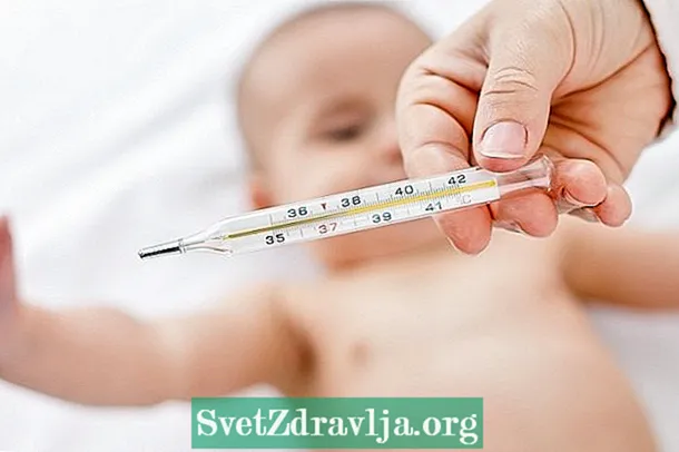 Si të lehtësoni simptomat e Zika tek foshnja