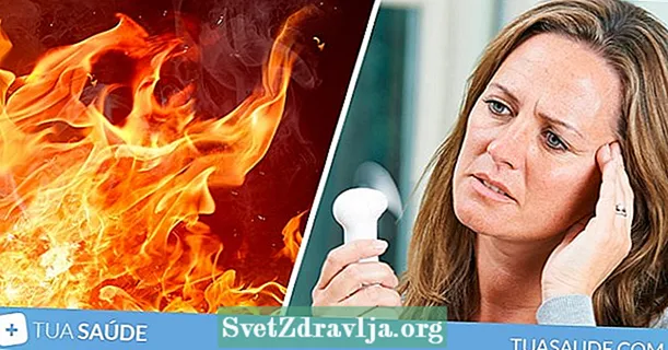 Како се борити против врућих бљесака менопаузе