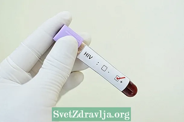 ŽIV tyrimo rezultatų supratimas