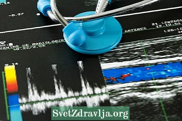Cara nggawe Ultrasound Doppler Warna lan nalika nindakake