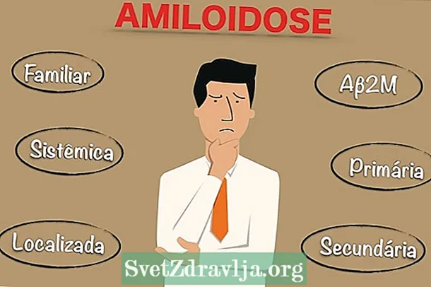 Como identificar a amiloidose