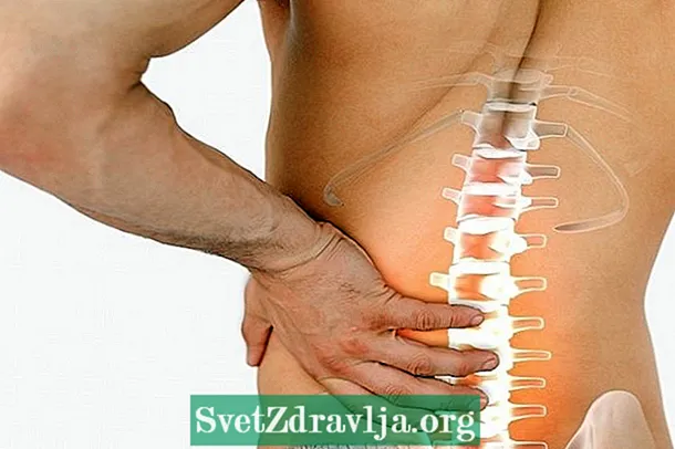 Πώς να αναγνωρίσετε τον πόνο στην πλάτη