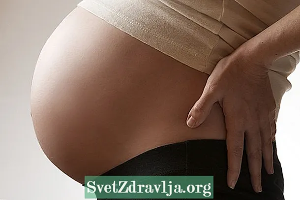 Kaip nustatyti ir gydyti išvaržų diskus nėštumo metu