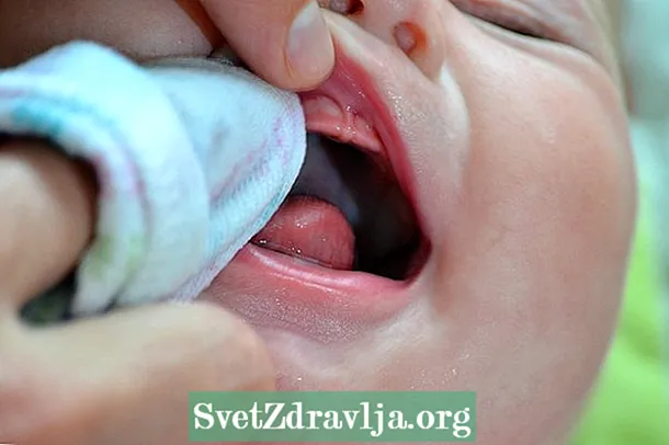 Hvordan rengjøre babyens tunge og munn