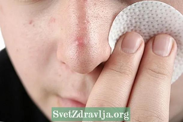 Sådan rengøres huden med acne - Fitness