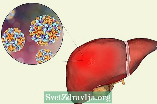 Hur man förhindrar hepatit A, B och C - Kondition
