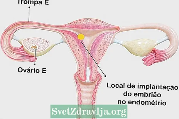 Cume trattà l'endometriu sottile per incinta