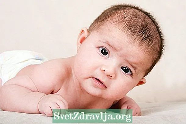 Kuinka hoitaa synnynnäistä kortikosteroottista vauvassa - Kunto