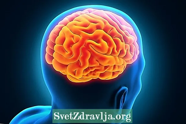 Craniopharyngioma: çi ye, nîşanên sereke, teşxîs û dermankirin