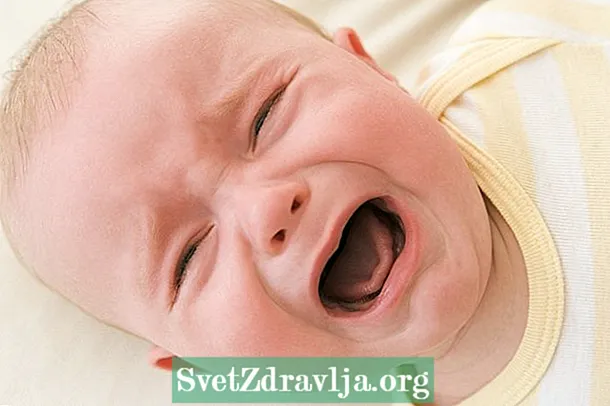 Convulsións de bebés: 3, 6, 8 e 12 meses