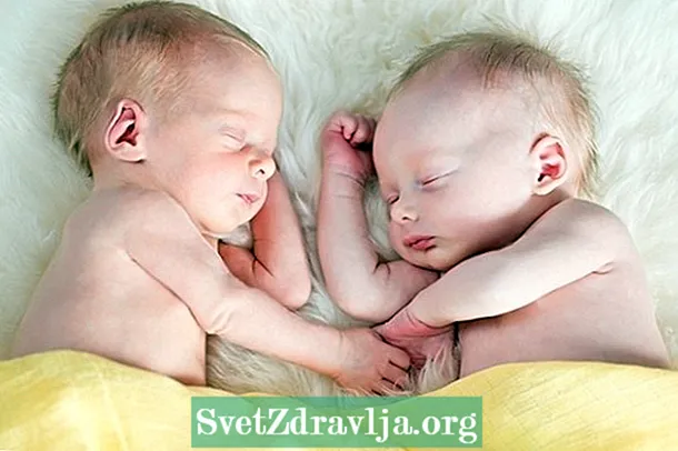 Briga tokom trudnoće blizanaca