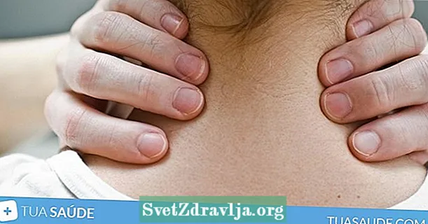 Dolor de cuello: 8 causas principales y como tratar
