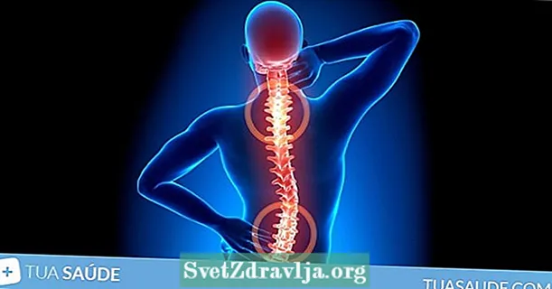 Nugaros skausmas: 8 pagrindinės priežastys ir ką daryti