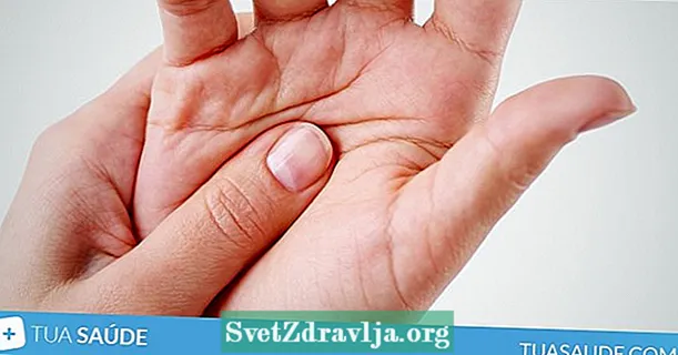હાથ પીડા: 10 મુખ્ય કારણો અને શું કરવું