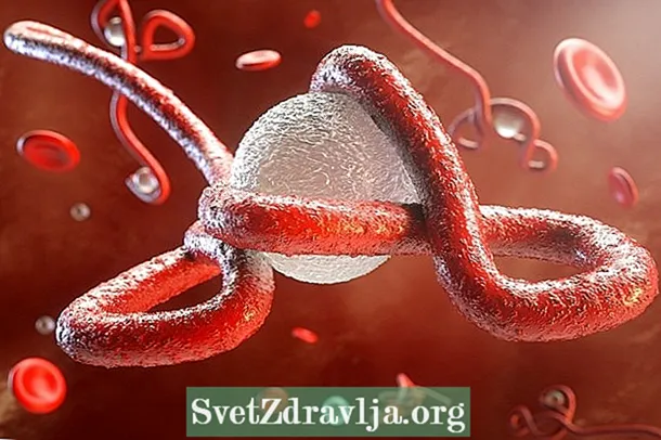 에볼라는 치료가 가능합니까? 치료 방법 및 개선 징후 이해