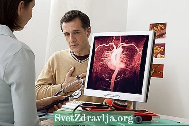 Ectasia dell'aorta: cos'è, quali sono i sintomi e come trattarla