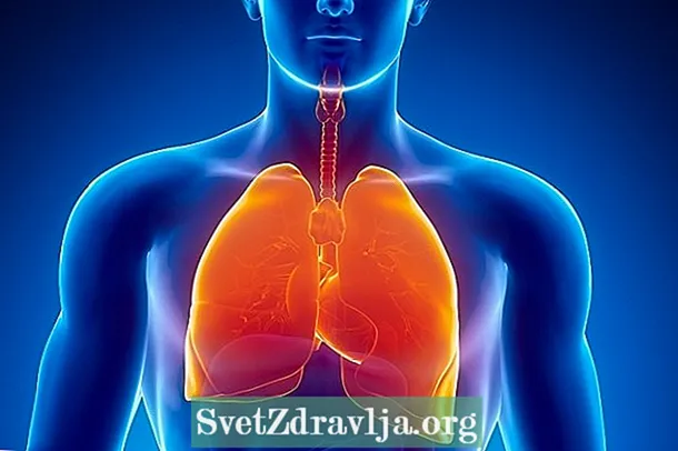 Emboli paru: apa itu, gejala dan sebab utama