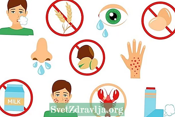 Razumeti, kako poteka zdravljenje alergije na hrano