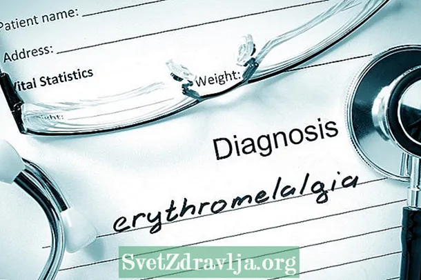 Eritromelalgija: kaj je to, simptomi, vzroki in zdravljenje