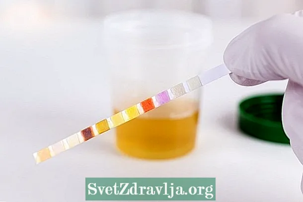 Tes urin (EAS): kanggo apa, persiyapan lan asil