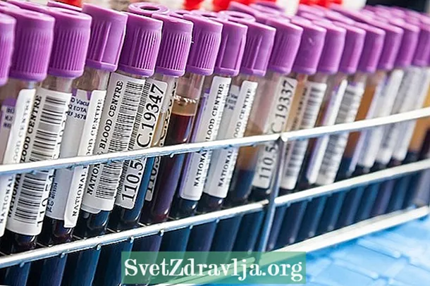 Tes darah yang mendeteksi kanker