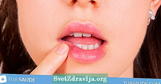 Рани по езика или гърлото: 5 основни причини и как да се лекува