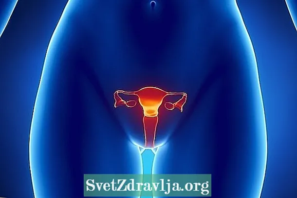 Ferida no útero: principais causas, síntomas e dúbidas comúns
