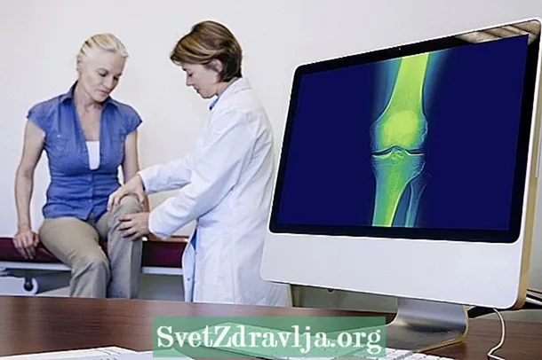 Physiotherapy don yaƙi da osteoporosis da Barfafa Kasusuwa - Kiwon Lafiya