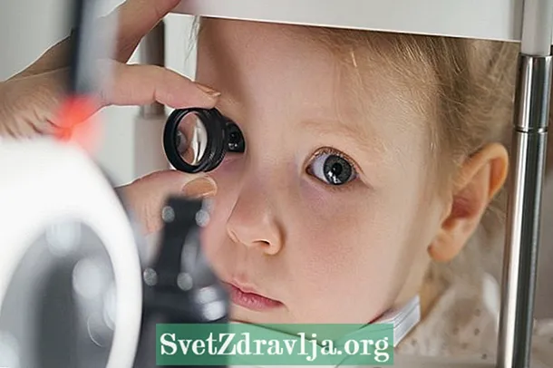 Congenital glaucoma: chii, nei zvichiitika uye kurapwa