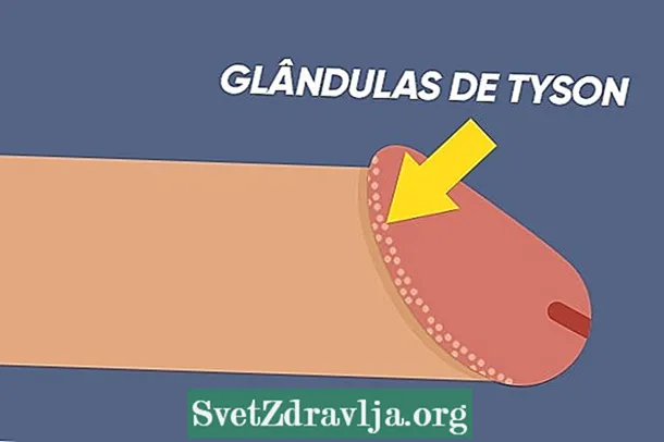 Glándulas de Tyson: que son, por que aparecen e cando tratar