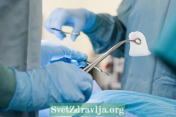 Gluteoplasty: ki sa li ye ak ki jan operasyon an fè
