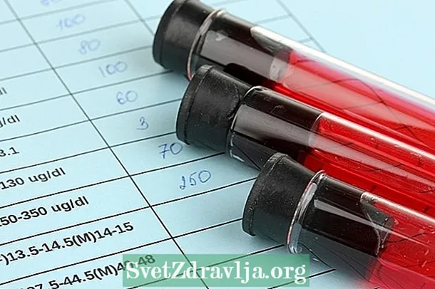 Paroxysmal hemoglobinuria nokturnal: naon éta sareng kumaha diagnosis didamel