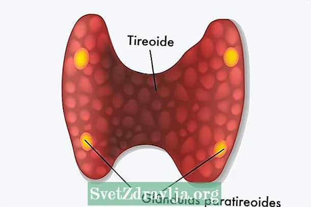 Hypoparathyroidism: hva det er, symptomer og behandling