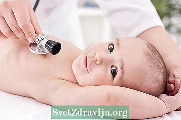 Bebekte göbek fıtığı: nedir, nedenleri ve tedavisi