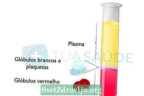 ല്യൂക്കോഗ്രാം: പരിശോധനാ ഫലം എങ്ങനെ മനസ്സിലാക്കാം