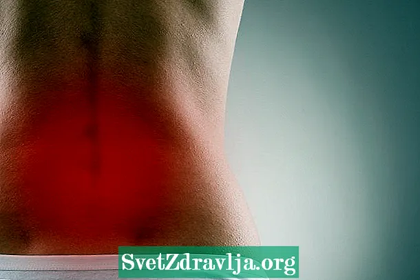 Болки во долниот дел на грбот: што е тоа, главни причини и третман