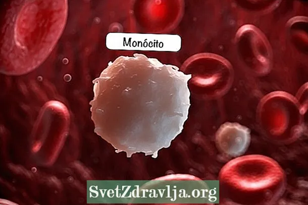 Ma monocyte: ndi chiyani komanso malingaliro ake