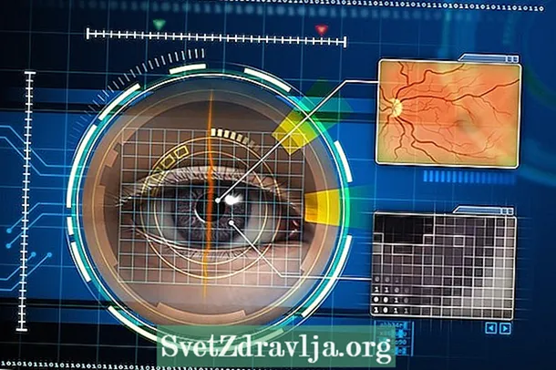 Mikä on Purtscher-retinopatia ja miten tunnistaa