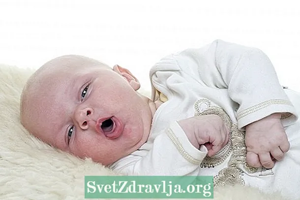 Baby Sizzler sindromi nima va uni qanday davolash kerak