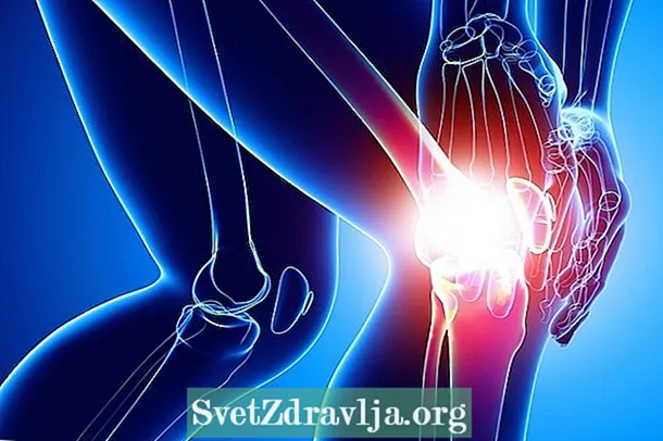 Was ist Schleimbeutelentzündung im Knie und wie zu behandeln - Fitness