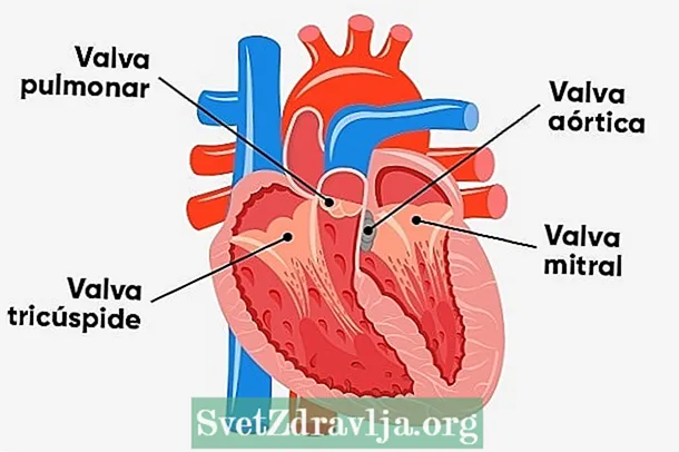 Mi a veleszületett szívbetegség és a fő típusok