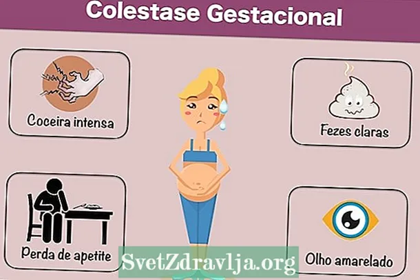 Gịnị bụ gestational cholestasis, mgbaàmà na ọgwụgwọ - Ahụ Ike