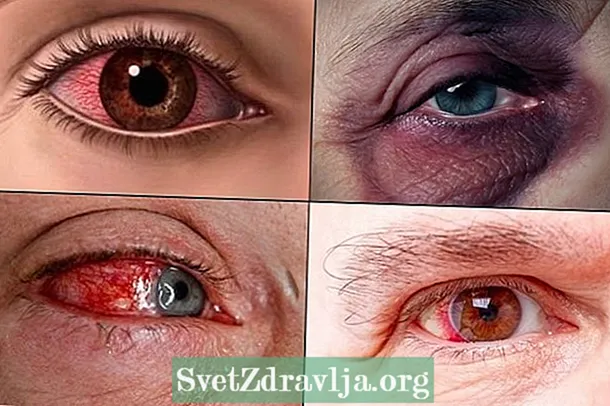 目の怪我の場合の対処法