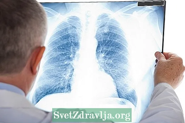Wat is pulmonale fibrose, haadsymptomen en behanneling