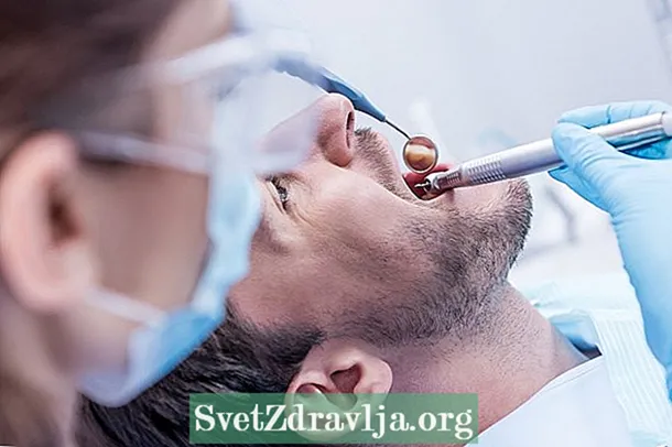 Ce este fistula dentară și cum se tratează