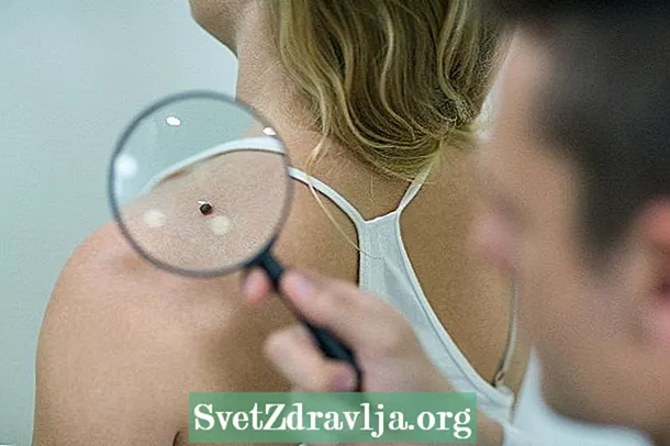 Ce este examenul dermatologic și cum se face