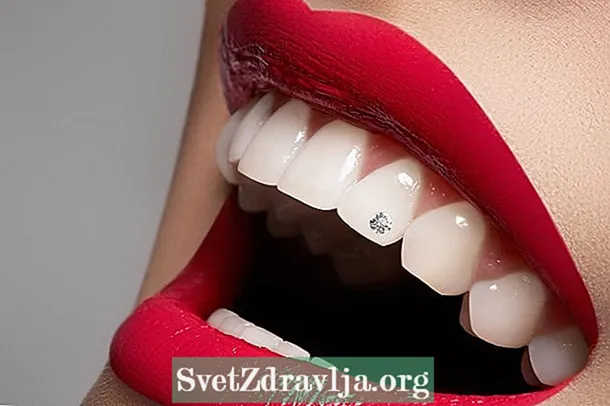 Kaj je zobni piercing in kako ga postaviti