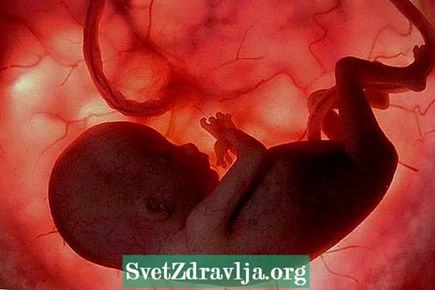 Cos'è l'angoscia fetale e quali sono i suoi segni