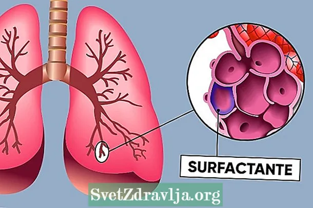Hvad er pulmonalt overfladeaktivt middel, og hvordan det fungerer