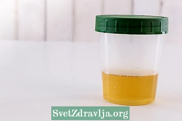 Hva kan være den økte bakteriefloraen i urinen og hva du skal gjøre
